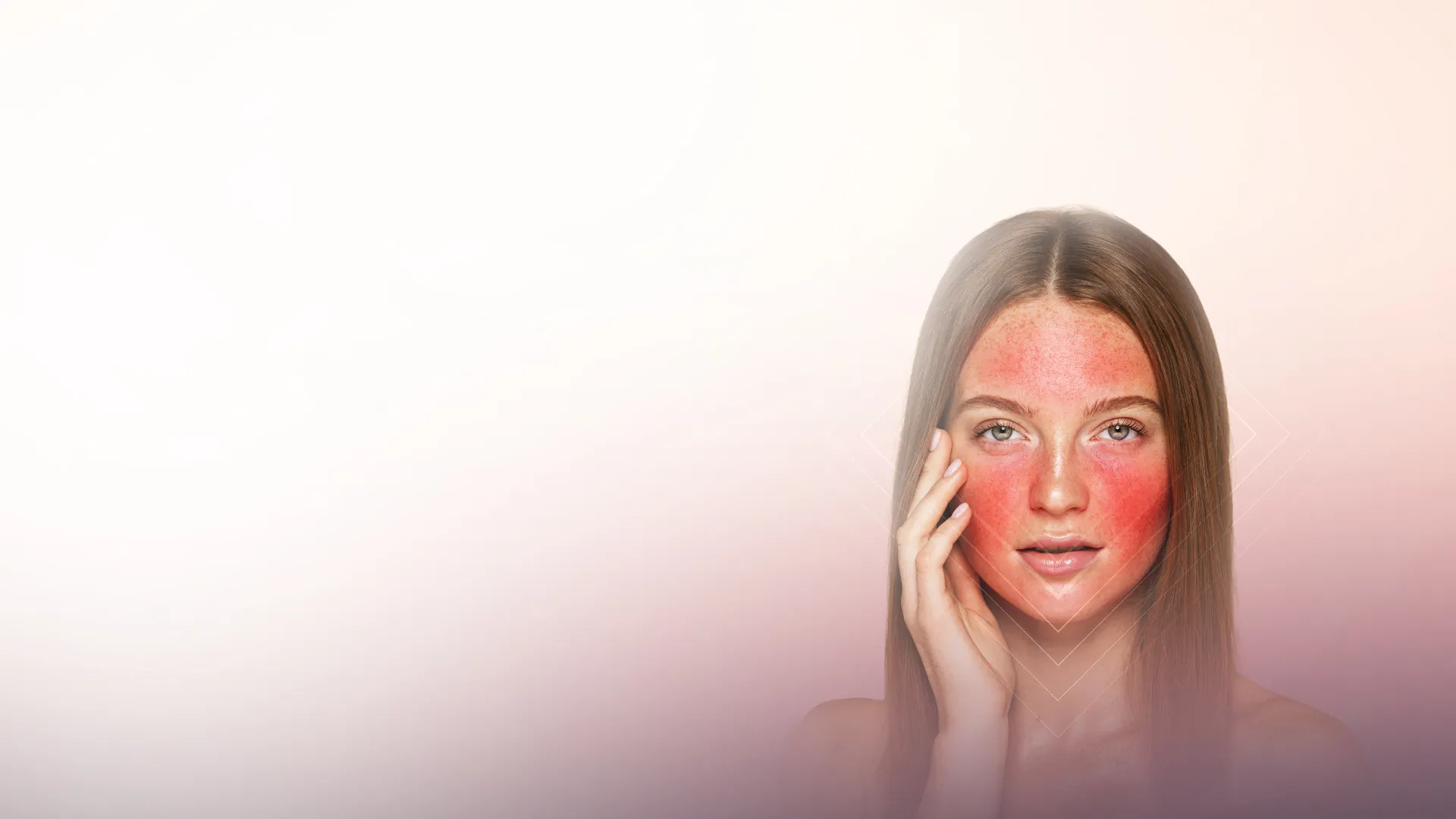 PRP Facial Rejuvenation (Vampire Facial) treatment at Toronto medical spa - Your Body Holds the Secret to Brighter, Firmer Skin...